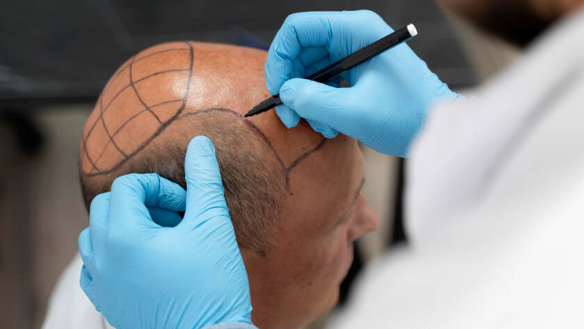 Hair Tattoo vs. Wigs
