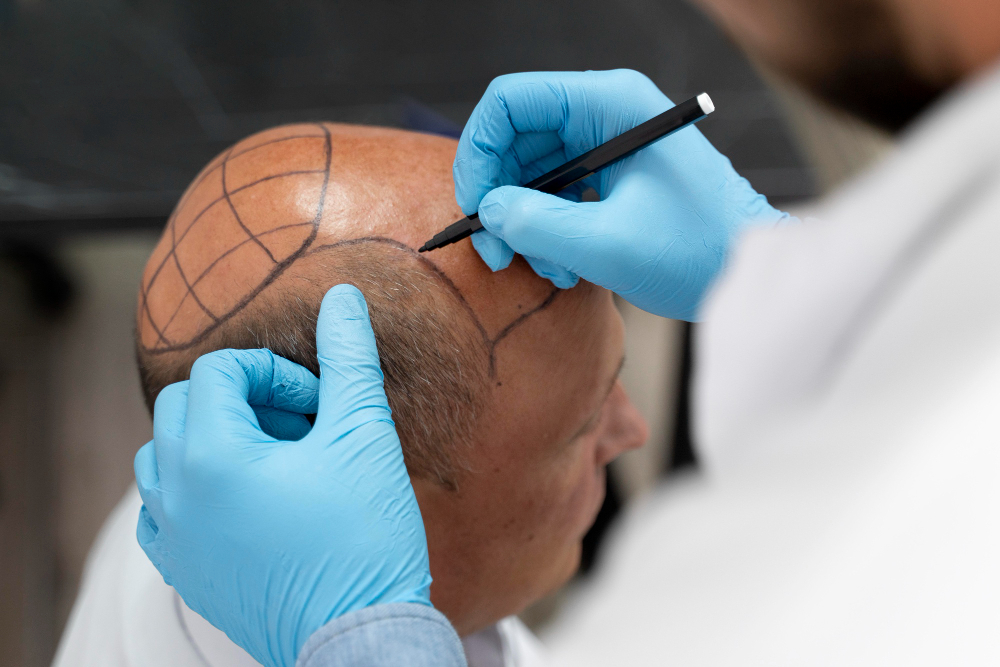 Hair Tattoo vs. Wigs